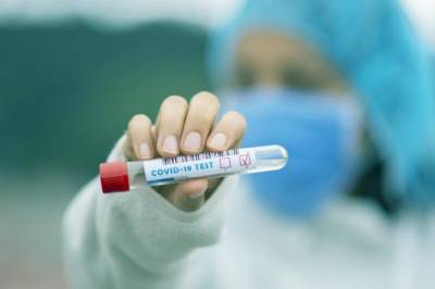 В Украине за минувшие сутки выявили 3285 новых случаев коронавируса, выздоровело - 10 101 пациент