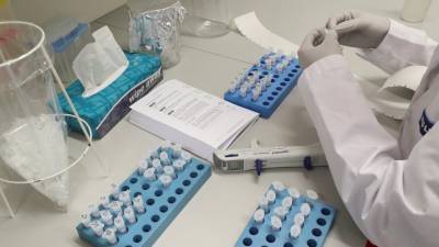Число случаев коронавируса в Чехии превысило 1 млн
