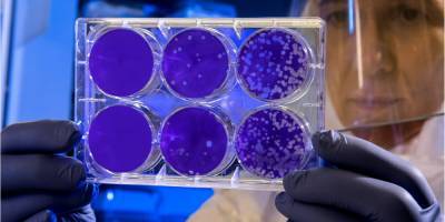 Пора начинать волноваться? Ученые раскрыли новый способ защиты бактерий от антибиотиков - nv.ua - США - Англия