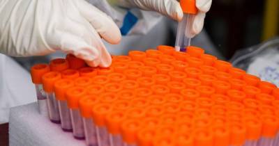 Эксперт ВОЗ не поверил в утечку коронавируса из лаборатории в Ухане