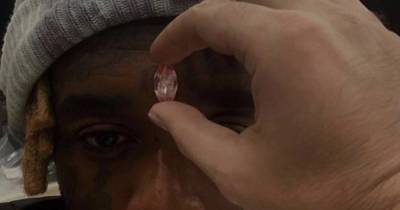 Американский рэпер Лил Узи Верт вживляет в лоб розовый бриллиант за 24 млн долларов