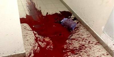 «Отрезанная голова свиньи и лужи крови»: АРМА жалуется на угрозы в адрес своих сотрудников