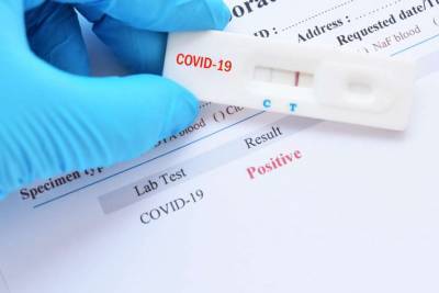 Сколько украинцев имеют иммунитет к COVID, показало исследование