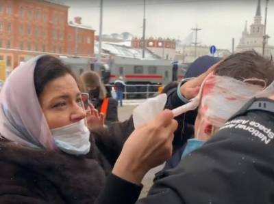 Избитая журналист Sobesednik.ru: Пятый день у меня не проходят следы от ударов дубинками