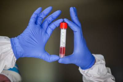 Определить коронавирус по дыханию: в Нидерландах проводят новые экспресс-тесты и мира