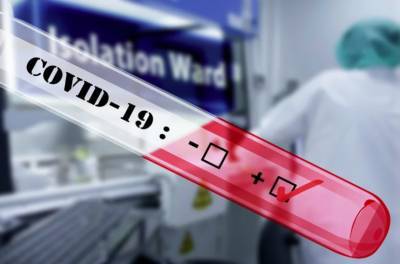 Израильский препарат от COVID 96% эффективности проходит стадию испытаний на людях