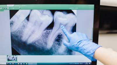 Объяснено влияние заболеваний ЖКТ на зубы человека