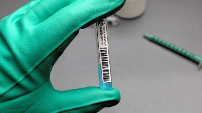 В России разработали метод быстрого тестирования на коронавирус