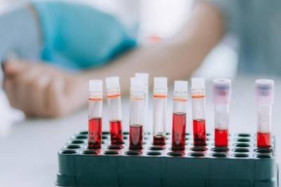Плазму крови для лечения COVID-19 впервые начали заготавливать в Забайкалье