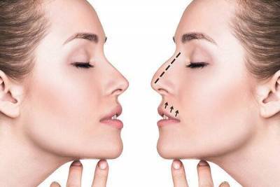Как изменить форму носа без операции: альтернативный способ