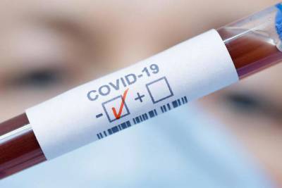 В Чувашии за сутки от COVID-19 выздоровели 115 человек