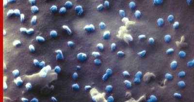 Ученые получили сверхточные снимки COVID-клеток гелий-ионным микроскопом