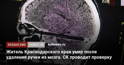 Житель Краснодарского края умер после удаления ручки из мозга. СК проводит проверку