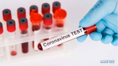 Центр медосмотров «Симплекс» начал тестирование и вакцинацию от COVID-19 мобильными медицинскими бригадами