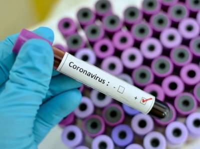 В Смоленской области за сутки выявили менее 80 заразившихся COVID-19