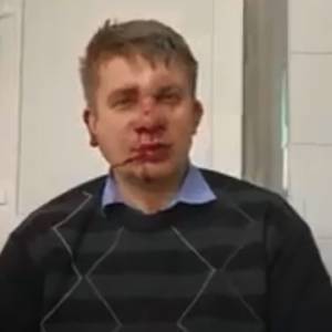 Запорожский депутат рассказал, как произошло нападение. Видео