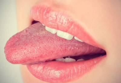 Медики назвали симптомы рака языка