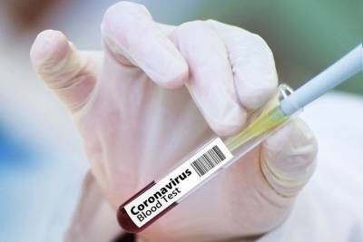 50 новых случаев заболевания коронавирусом выявили в Татарстане
