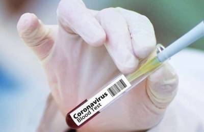 На Киевщине в два раза выросла заболеваемость коронавирусом