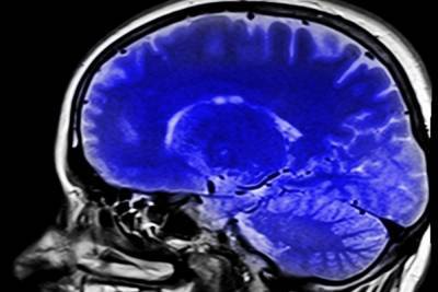 Ученые назвали главные факторы старения мозга