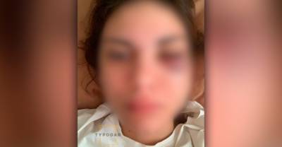 В Краснодаре 17-летнюю девушку избили в трамвае за случайный мат