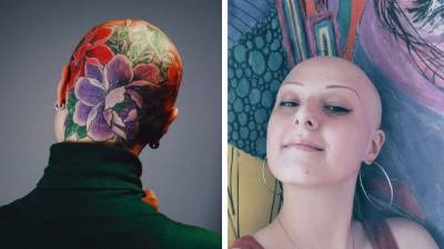 Женщина начала лысеть из-за болезни: теперь на ее голове "растут" цветы