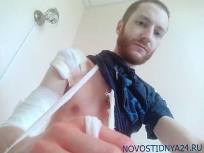 Журналист, избитый полицейскими на избирательном участке в Петербурге, обратился в ЕСПЧ