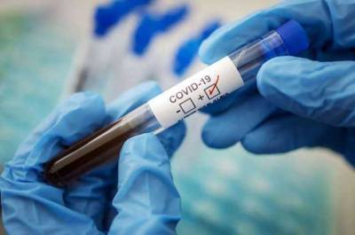 В НАН заявили, что весенняя волна коронавируса опаснее осенней