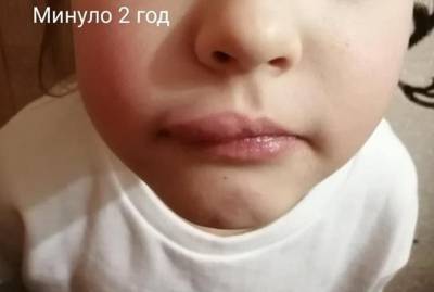 Дело детского стоматолога из Ровно, которая била пациентов, направили в суд