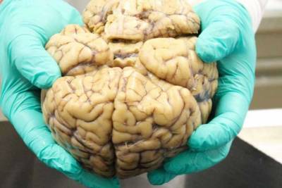Ученые выяснили, почему стареет человеческий мозг