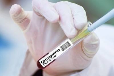 50 новых случаев заболевания коронавирусом выявили в Татарстане