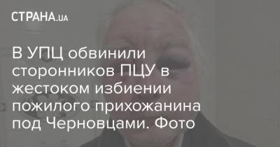 В УПЦ обвинили сторонников ПЦУ в жестоком избиении пожилого прихожанина под Черновцами. Фото