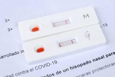 Надо ли перед вакцинацией сдавать тест на антитела: в Минздраве дали ответ