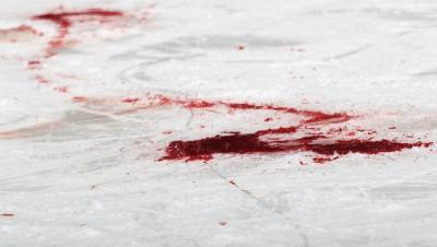 В Петрозаводске мужчина погиб от упавшего с крыши льда