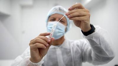В Роспотребнадзоре создали тест для определения количества коронавируса