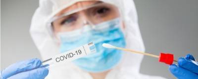 В Роспотребнадзоре создали первый тест для определения количества коронавируса в биоматериале