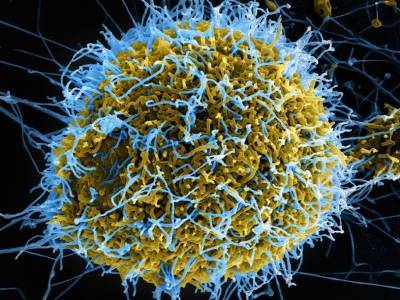 Источником новой вспышки лихорадки Эбола мог стать человек, заразившийся пять лет назад