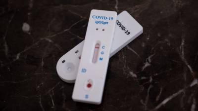Прибор для проверки на антитела к COVID-19 на дому создадут в России
