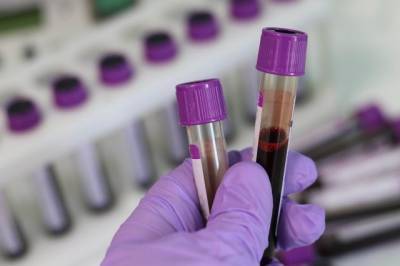 В России выявили минимум заболевших коронавирусом с 1 октября