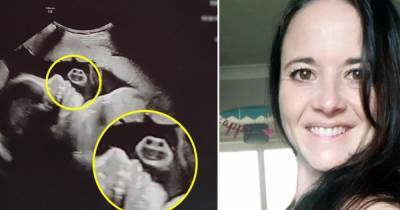 Беременная увидела загадочное "лицо" рядом с ребенком на снимке УЗИ