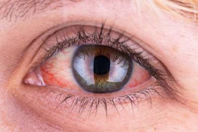 Названы опасные симптомы болезней глаз, с которыми нужно срочно обратиться к врачу