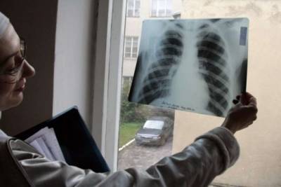 За месяц в Украине выявили почти 1500 случаев туберкулеза