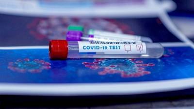 Ученые назвали группу риска повторного заражения коронавирусом