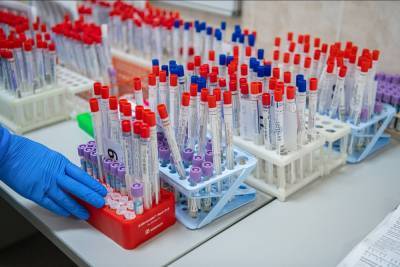 Антитела к коронавирусу, тест на ВИЧ и гепатиты: Жители Северодонецка и региона могут бесплатно пройти тестирование
