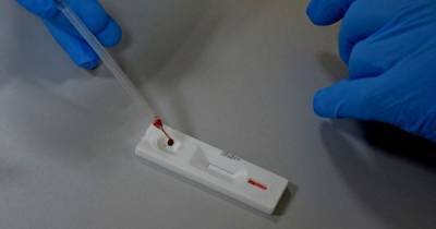 Украинцев будут массово тестировать на наличие антител к COVID-19