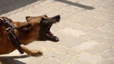 Жители Новосибирска высказались о крутом нраве хозяйки покусавшего школьника пса