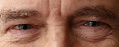 Болезнь Альцгеймера научились диагностировать по глазам