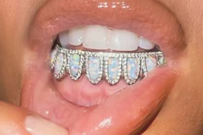 Ким Кардашьян похвасталась бриллиантами на зубах и разочаровала поклонников