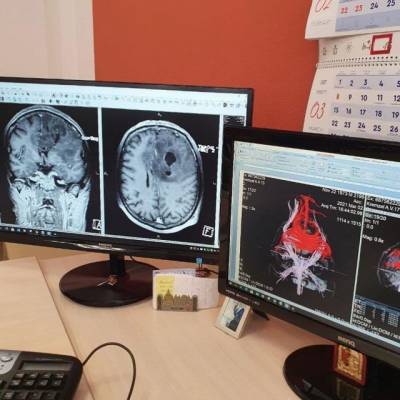 В Кемерове врачи удалили пациенту опухоль головного мозга размером с гранат