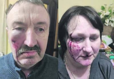 Под Киевом газовщик избил пенсионеров